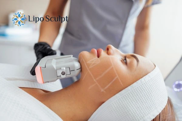 HIFU vs Botulinum Toxin: Understanding the Differences 1 HIFU vs Botox Midhurst What is the best option for you?