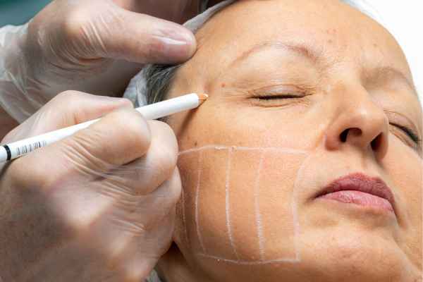 CryoPen: 5 Skin Concerns It May Be Used to Treat 4 What should you ask before having CryoPen treatment Midhurst?