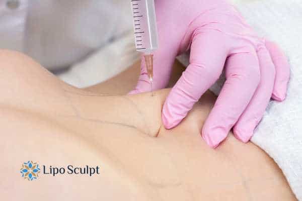 Aqualyx for Muffin Tops: What to Know Before Fat-Dissolving Injections 4 Are there risks Midhurst?
